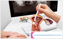[TP.HCM] 5 địa chỉ phòng khám phụ khoa TPHCM chất lượng nhất 2022