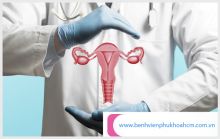 Tin tức và nghiên cứu mới nhất về bệnh tử cung chị em cần biết
