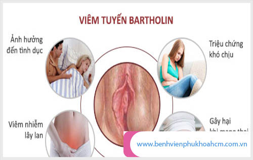 hình ảnh căn bệnh viêm tuyến bartholin