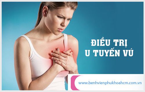 Điều trị u tuyến vú an toàn mang lại hiệu quả cao