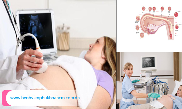 Mang thai đến tuần thứ mấy thì mẹ bầu nên đi siêu âm Thai-may-tuan-thi-vao-tu-cung2