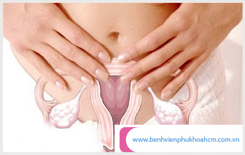 Hình ảnh tử cung bị viêm mãn tính khó điều trị khỏi